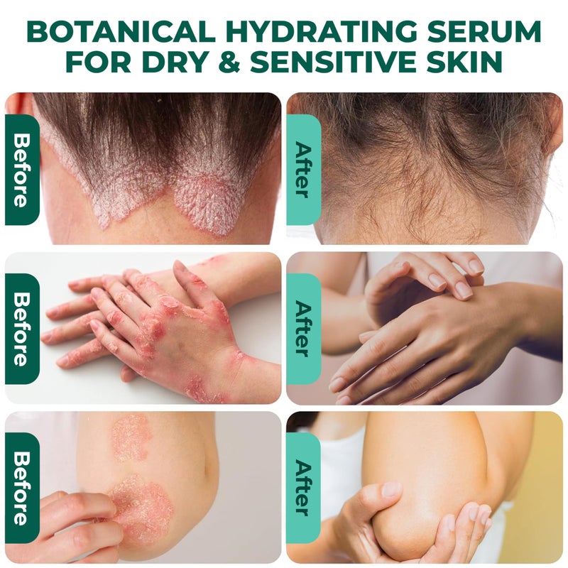ABERA Alan Silver Serum – Botanical Hydrating Serum for Dry & Sensitive Skin – Nourishes & Moisturizes with Black Ginger, Cedar Oil & Neem – Lightweight Formula for All Skin Types - Image 3